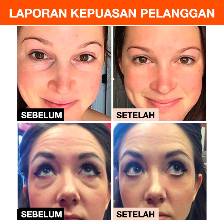 Anti-Wrinkle Eye Serum-direkomendasikan oleh dokter di salon kecantikan Korea-mengurangi kantung mata, lingkaran hitam, menghilangkan kerutan mata-sepuluh tahun lebih muda dalam tujuh hari